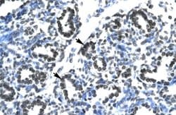 Invitrogen Claudin 17 Polyclonal Antibody 100 &mu;L; Unconjugated:Antibodies,