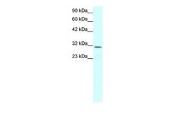 Invitrogen Claudin 17 Polyclonal Antibody 100 &mu;L; Unconjugated:Antibodies,