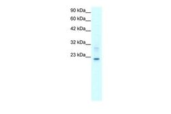 Invitrogen Claudin 9 Polyclonal Antibody 100 &mu;L | Buy Online | Invitrogen&trade; | Fisher Scientific