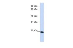 Invitrogen Claudin 19 Polyclonal Antibody 100 &mu;L | Buy Online | Invitrogen&trade; | Fisher Scientific
