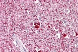 Invitrogen ZEB2 Polyclonal Antibody 100 &mu;L; Unconjugated:Antibodies,