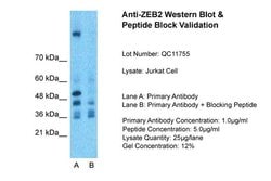 Invitrogen ZEB2 Polyclonal Antibody 100 &mu;L; Unconjugated:Antibodies,