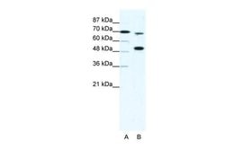Invitrogen MLL4 Polyclonal Antibody 100 &mu;L; Unconjugated:Antibodies,