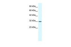 Invitrogen MORF4L2 Polyclonal Antibody 100 &mu;L; Unconjugated:Antibodies,