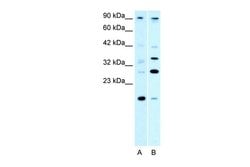 Invitrogen KIF3B Polyclonal Antibody 100 &mu;L; Unconjugated:Antibodies,
