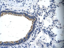 Invitrogen ASGR2 Polyclonal Antibody 100 &mu;L; Unconjugated:Antibodies,