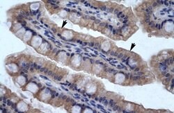 Invitrogen SMPDL3B Polyclonal Antibody 100 &mu;L; Unconjugated:Antibodies,