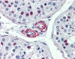 Invitrogen KIF13B Polyclonal Antibody 100 &mu;L; Unconjugated:Antibodies,