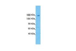 Invitrogen KIF21A Polyclonal Antibody 100 &mu;L; Unconjugated:Antibodies,