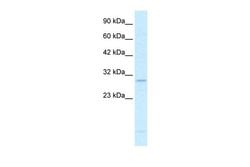 Invitrogen RALY Polyclonal Antibody 100 &mu;L; Unconjugated:Antibodies,