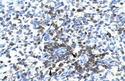 Invitrogen RCOR3 Polyclonal Antibody 100 &mu;L; Unconjugated:Antibodies,