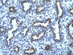 Invitrogen RFP2 Polyclonal Antibody 100 &mu;L; Unconjugated:Antibodies,