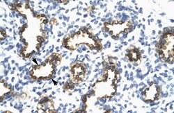 Invitrogen RFP2 Polyclonal Antibody 100 &mu;L; Unconjugated:Antibodies,