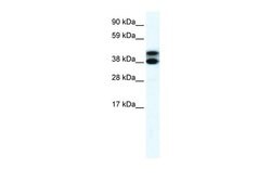 Invitrogen RFP2 Polyclonal Antibody 100 &mu;L; Unconjugated:Antibodies,
