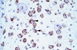 Invitrogen MED17 Polyclonal Antibody 100 &mu;L; Unconjugated:Antibodies,