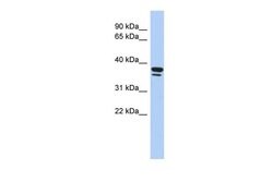 Invitrogen EGR3 Polyclonal Antibody 100 &mu;L; Unconjugated:Antibodies,