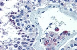 Invitrogen ASH2L Polyclonal Antibody 100 &mu;L; Unconjugated:Antibodies,