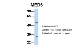 Invitrogen MED6 Polyclonal Antibody 100 &mu;L; Unconjugated:Antibodies,