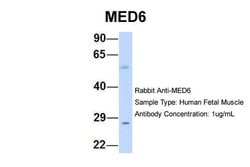 Invitrogen MED6 Polyclonal Antibody 100 &mu;L; Unconjugated:Antibodies,