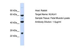 Invitrogen KLHL41 Polyclonal Antibody 100 &mu;L; Unconjugated:Antibodies,