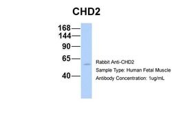 Invitrogen CHD2 Polyclonal Antibody 100 &mu;L; Unconjugated:Antibodies,