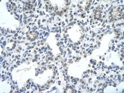 Invitrogen RASSF7 Polyclonal Antibody 100 &mu;L; Unconjugated:Antibodies,