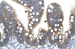 Invitrogen TFB2M Polyclonal Antibody 100 &mu;L; Unconjugated:Antibodies,