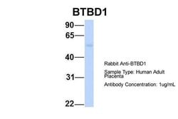 Invitrogen BTBD1 Polyclonal Antibody 100 &mu;L; Unconjugated:Antibodies,