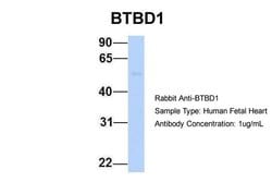 Invitrogen BTBD1 Polyclonal Antibody 100 &mu;L; Unconjugated:Antibodies,