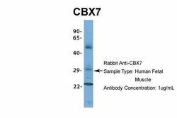 Invitrogen CBX7 Polyclonal Antibody 100 &mu;L | Buy Online | Invitrogen&trade; | Fisher Scientific