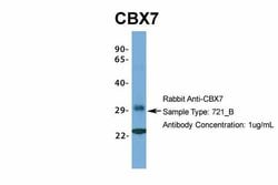 Invitrogen CBX7 Polyclonal Antibody 100 &mu;L | Buy Online | Invitrogen&trade; | Fisher Scientific