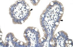 Invitrogen IkB beta Polyclonal Antibody 100 &mu;L; Unconjugated:Antibodies,