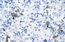 Invitrogen TRIM17 Polyclonal Antibody 100 &mu;L; Unconjugated:Antibodies,