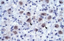 Invitrogen RNF141 Polyclonal Antibody 100 &mu;L; Unconjugated:Antibodies,