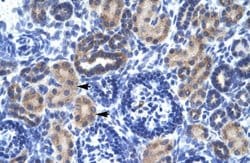 Invitrogen RNF141 Polyclonal Antibody 100 &mu;L; Unconjugated:Antibodies,