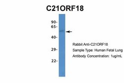 SETD4 Rabbit anti-Bovine, Canine, Equine, Guinea Pig, Human, Mouse, Rabbit,