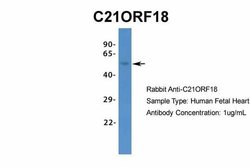 SETD4 Rabbit anti-Bovine, Canine, Equine, Guinea Pig, Human, Mouse, Rabbit,