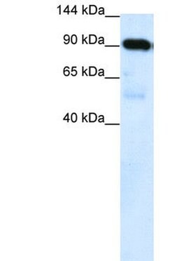 Invitrogen SUV420H1 Polyclonal Antibody 100 &mu;L | Buy Online | Invitrogen&trade; | Fisher Scientific