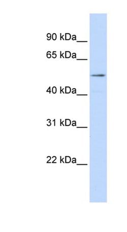 Invitrogen SUV420H1 Polyclonal Antibody 100 &mu;L | Buy Online | Invitrogen&trade; | Fisher Scientific