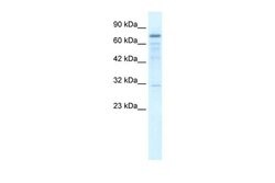 Invitrogen TRMT1 Polyclonal Antibody 100 &mu;L; Unconjugated:Antibodies,