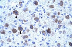 Invitrogen KCNIP4 Polyclonal Antibody 100 &mu;L; Unconjugated:Antibodies,