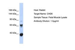 CHD6 Polyclonal Antibody, Invitrogen 100 &mu;L; Unconjugated:Antibodies,