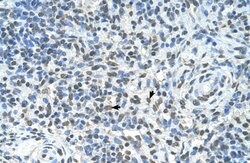 Invitrogen ZMYND11 Polyclonal Antibody 100 &mu;L; Unconjugated:Antibodies,