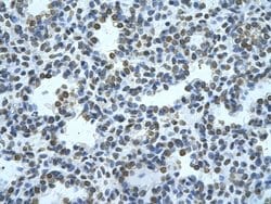 Invitrogen ZMYND11 Polyclonal Antibody 100 &mu;L; Unconjugated:Antibodies,