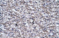 Invitrogen UHRF2 Polyclonal Antibody 100 &mu;L; Unconjugated:Antibodies,