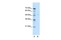 Invitrogen TRIM38 Polyclonal Antibody 100 μL; Unconjugated:Antibodies,