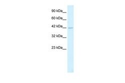 Invitrogen HSF2BP Polyclonal Antibody 100 μL; Unconjugated:Antibodies,
