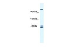 Invitrogen NMDAR2C Polyclonal Antibody 100 &mu;L; Unconjugated:Antibodies,
