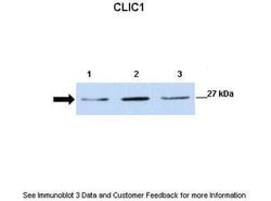 Invitrogen CLIC1 Polyclonal Antibody 100 &mu;L | Buy Online | Invitrogen&trade; | Fisher Scientific
