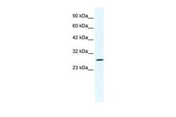 Invitrogen CLIC1 Polyclonal Antibody 100 &mu;L | Buy Online | Invitrogen&trade; | Fisher Scientific